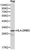 Major Histocompatibility Complex, Class II, DR Beta 4 antibody, A01514, Boster Biological Technology, Western Blot image 