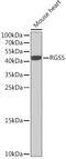 Regulator of G-protein signaling 5 antibody, GTX64682, GeneTex, Western Blot image 