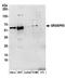Golgi reassembly-stacking protein 1 antibody, NBP2-36527, Novus Biologicals, Western Blot image 