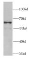 Proteasome 26S Subunit, Non-ATPase 3 antibody, FNab06888, FineTest, Western Blot image 