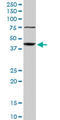 Abhydrolase Domain Containing 5 antibody, LS-B5751, Lifespan Biosciences, Western Blot image 