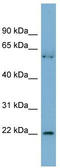 PRELI Domain Containing 3B antibody, TA345077, Origene, Western Blot image 