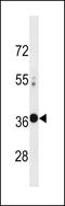 Ventral Anterior Homeobox 2 antibody, 60-607, ProSci, Western Blot image 