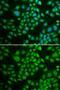 Deoxycytidine kinase antibody, GTX32553, GeneTex, Immunofluorescence image 