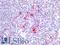 Integrin Subunit Beta 2 antibody, LS-B16864, Lifespan Biosciences, Immunohistochemistry paraffin image 