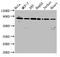 Leucine Zipper And EF-Hand Containing Transmembrane Protein 1 antibody, LS-C673710, Lifespan Biosciences, Western Blot image 