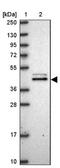 Mevalonate Diphosphate Decarboxylase antibody, NBP2-13629, Novus Biologicals, Western Blot image 