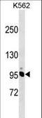 Non-SMC Condensin I Complex Subunit H antibody, LS-B13772, Lifespan Biosciences, Western Blot image 