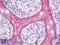 Villin 1 antibody, LS-B8547, Lifespan Biosciences, Immunohistochemistry paraffin image 