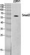 SMAD2 antibody, STJ95696, St John