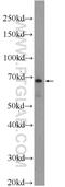 LARGE Xylosyl- And Glucuronyltransferase 1 antibody, 24307-1-AP, Proteintech Group, Western Blot image 