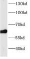 Bardet-Biedl Syndrome 4 antibody, FNab00818, FineTest, Western Blot image 