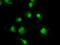 TYRO3 Protein Tyrosine Kinase antibody, GTX83458, GeneTex, Immunocytochemistry image 