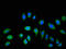 ATPase H+ Transporting V1 Subunit C2 antibody, LS-C672581, Lifespan Biosciences, Immunofluorescence image 