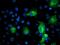 Phosphofructokinase, Platelet antibody, MA5-25792, Invitrogen Antibodies, Immunocytochemistry image 