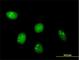 Chromosome 8 Open Reading Frame 33 antibody, H00065265-B01P, Novus Biologicals, Immunofluorescence image 