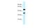 Retinol Dehydrogenase 13 antibody, A12202, Boster Biological Technology, Western Blot image 
