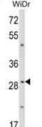 ZFP36 Ring Finger Protein antibody, abx034172, Abbexa, Western Blot image 