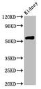 Hydroxymethylglutaryl-CoA synthase, mitochondrial antibody, CSB-PA010567LA01HU, Cusabio, Western Blot image 