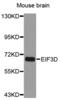 Eukaryotic Translation Initiation Factor 3 Subunit D antibody, abx004562, Abbexa, Western Blot image 
