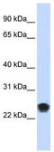 FKBP Prolyl Isomerase 11 antibody, TA342020, Origene, Western Blot image 