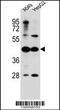 Acyl-CoA Synthetase Medium Chain Family Member 6 antibody, 56-530, ProSci, Western Blot image 