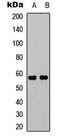 UBX Domain Protein 11 antibody, LS-C368540, Lifespan Biosciences, Western Blot image 