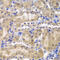 Ribosomal Protein L5 antibody, 18-425, ProSci, Immunohistochemistry paraffin image 