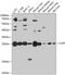Caseinolytic Mitochondrial Matrix Peptidase Proteolytic Subunit antibody, GTX64536, GeneTex, Western Blot image 