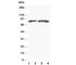 Metastasis Associated 1 antibody, R30555, NSJ Bioreagents, Western Blot image 