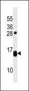 TP53-target gene 1 protein antibody, PA5-72120, Invitrogen Antibodies, Western Blot image 