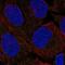 FA Complementation Group L antibody, NBP1-84758, Novus Biologicals, Immunofluorescence image 