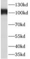 A-Kinase Anchoring Protein 3 antibody, FNab00254, FineTest, Western Blot image 