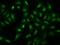 Nucleoporin 188 antibody, 205223-T02, Sino Biological, Immunohistochemistry paraffin image 