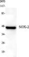 Quiescin Sulfhydryl Oxidase 1 antibody, STJ98555, St John