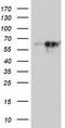 Monoamine Oxidase A antibody, TA504266S, Origene, Western Blot image 