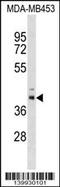 Mitochondrial tRNA-specific 2-thiouridylase 1 antibody, 60-317, ProSci, Western Blot image 