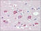 Histone-lysine N-methyltransferase MLL2 antibody, AP22567PU-N, Origene, Immunohistochemistry paraffin image 