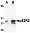 Ribonucleoside-diphosphate reductase subunit M2 B antibody, PA5-19970, Invitrogen Antibodies, Western Blot image 