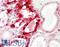 Renin-1 antibody, LS-B13038, Lifespan Biosciences, Immunohistochemistry paraffin image 