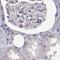NHP2 Ribonucleoprotein antibody, PA5-62181, Invitrogen Antibodies, Immunohistochemistry paraffin image 