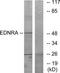 Endothelin Receptor Type A antibody, TA313783, Origene, Western Blot image 
