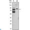 Kelch Like Family Member 11 antibody, LS-C812674, Lifespan Biosciences, Western Blot image 