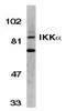 Inhibitor of nuclear factor kappa-B kinase subunit alpha antibody, TA305995, Origene, Western Blot image 