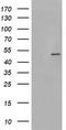 Phosphorylase Kinase Catalytic Subunit Gamma 2 antibody, TA800343AM, Origene, Western Blot image 