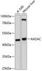 Arylacetamide Deacetylase antibody, GTX64718, GeneTex, Western Blot image 