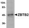 Zinc Finger And BTB Domain Containing 1 antibody, TA306699, Origene, Western Blot image 