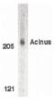 Apoptotic Chromatin Condensation Inducer 1 antibody, PA5-19938, Invitrogen Antibodies, Western Blot image 