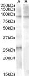 Apolipoprotein B MRNA Editing Enzyme Catalytic Subunit 2 antibody, NB100-93372, Novus Biologicals, Western Blot image 