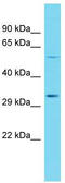 Cyclin Dependent Kinase Like 4 antibody, TA334864, Origene, Western Blot image 